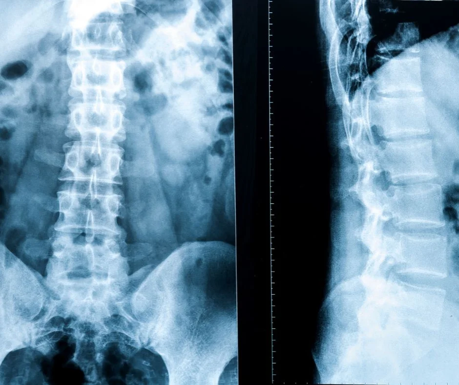 Chiropractic-anatomy