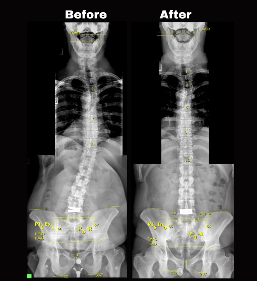 Chiropractor Centennial Expertise