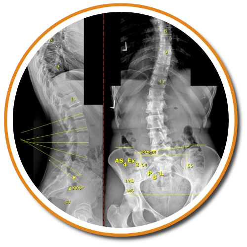 ✳︎Gonstead Chiropractic Science & Art✳︎ Gonstead Chiropractic Science & Art: The Chiropractic