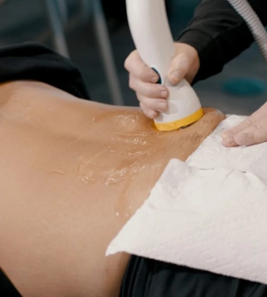 softwave therapy in centennial
